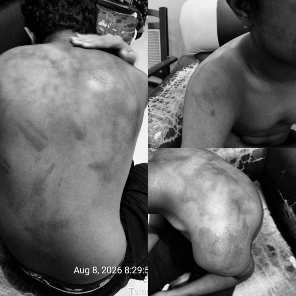 శ్రీచైతన్య స్కూల్లో విద్యార్థిపై దారుణంగా దాడి చేసిన తోటి విద్యార్థులు