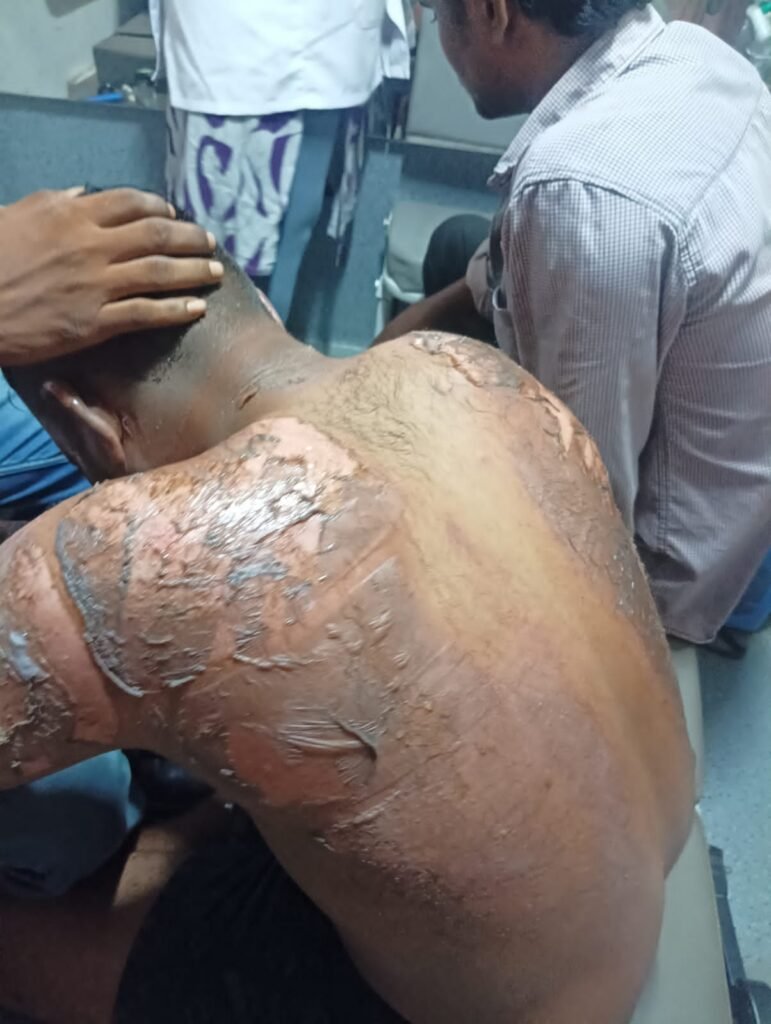 యాదాద్రి జిల్లాలో ఫార్మా కంపెనీలో భారీగా పేలుడు ప్రమాదం
