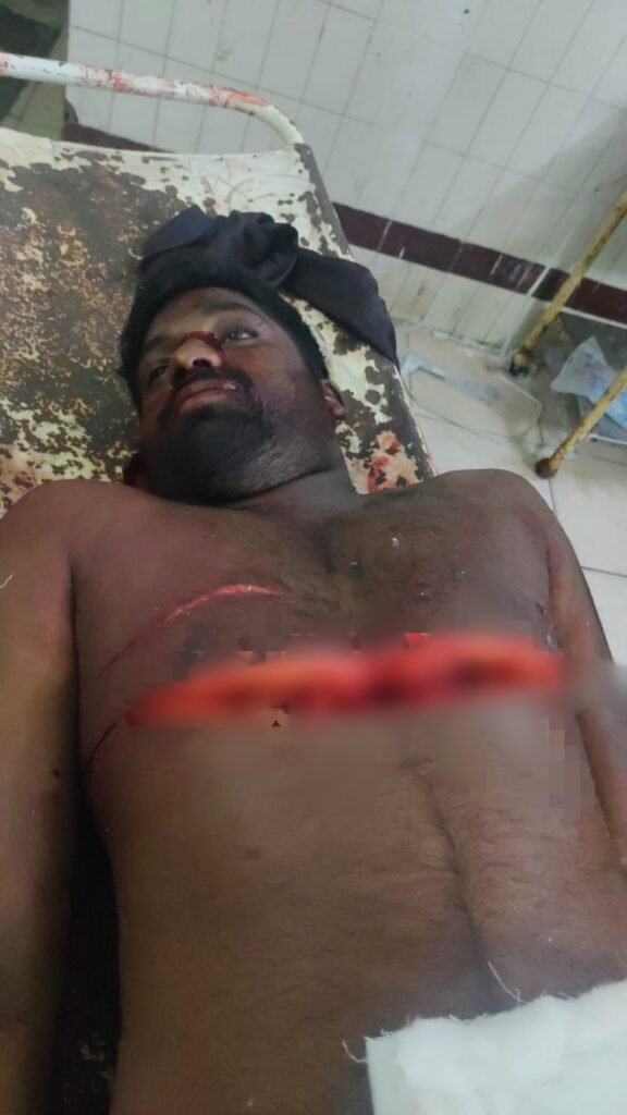 మామునూరులో దారుణ హత్య నాయుడు పెట్రోల్‌ పంపు సమీపంలో యువకుడి హత్య.. ఒకరు అదుపులో!